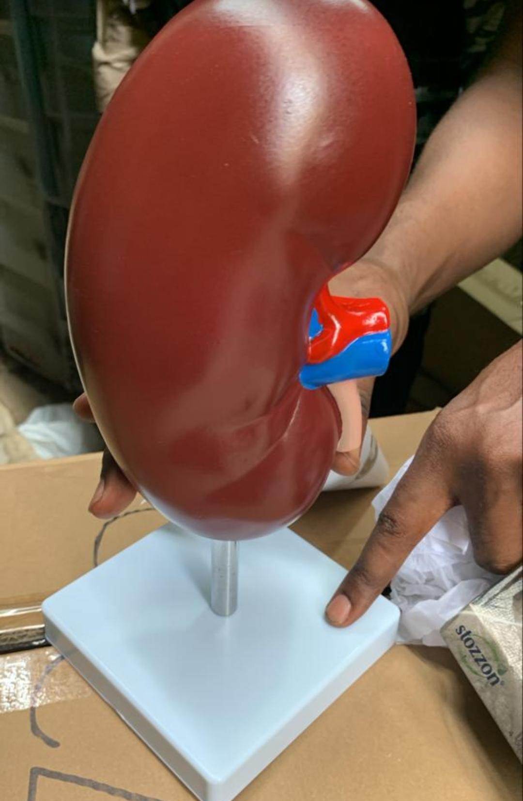 Giant Kidney Anatomical Model with Stand